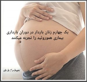 بیماری هموروئید در بارداری