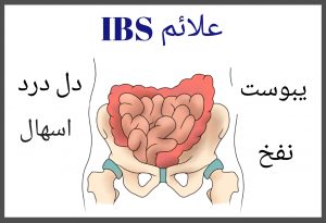 علت سندرم روده تحریک پذیر IBS