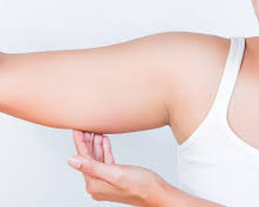 لیپوساکشن بازو جهت رفع چاقی بازو